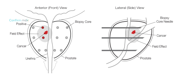 MDX1041-prostate-drw-2